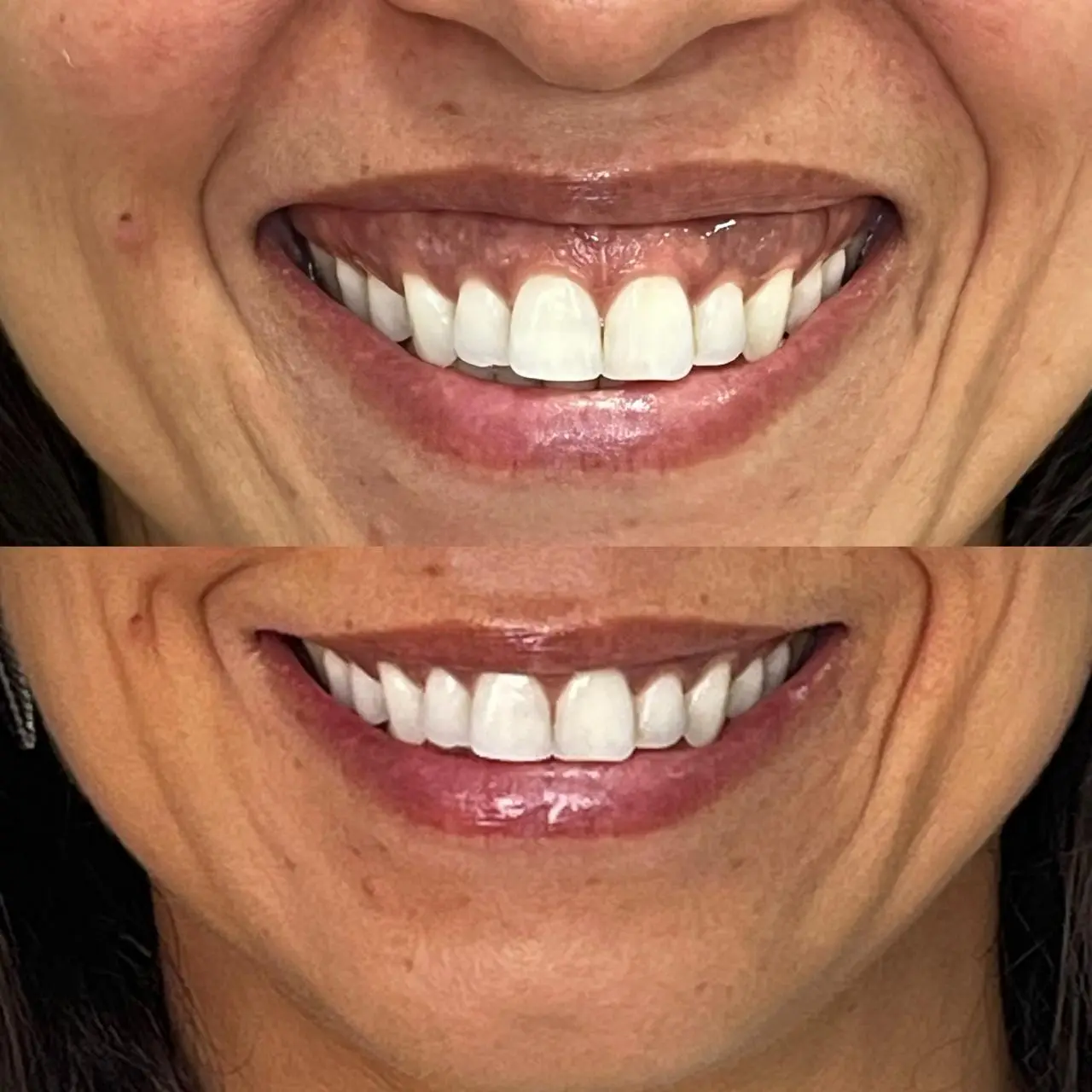 Antes e depois (autorizado)