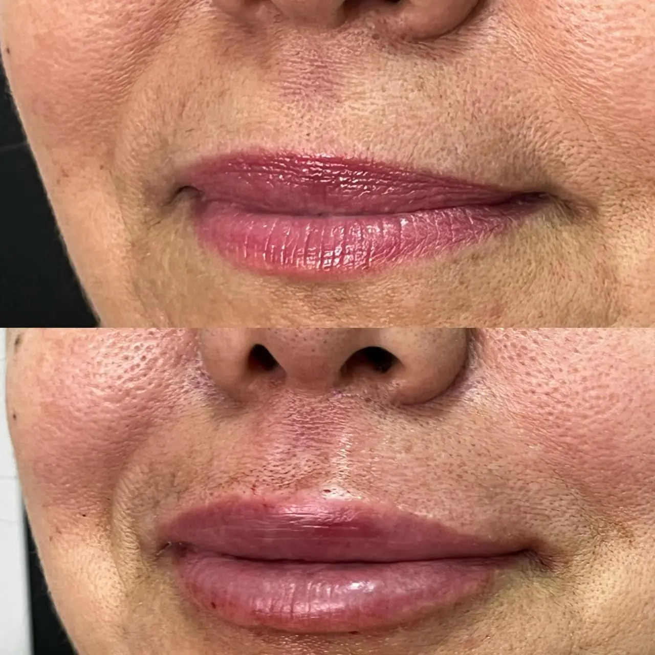 Antes e depois (autorizado)