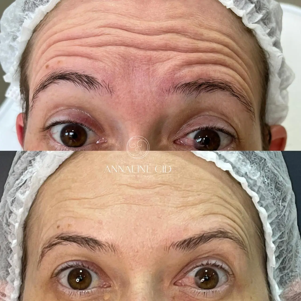Antes e depois (autorizado)